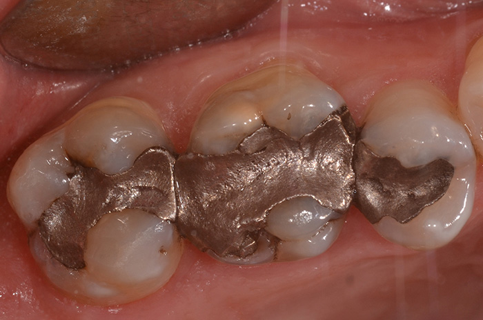 pre-terapia Conservativa