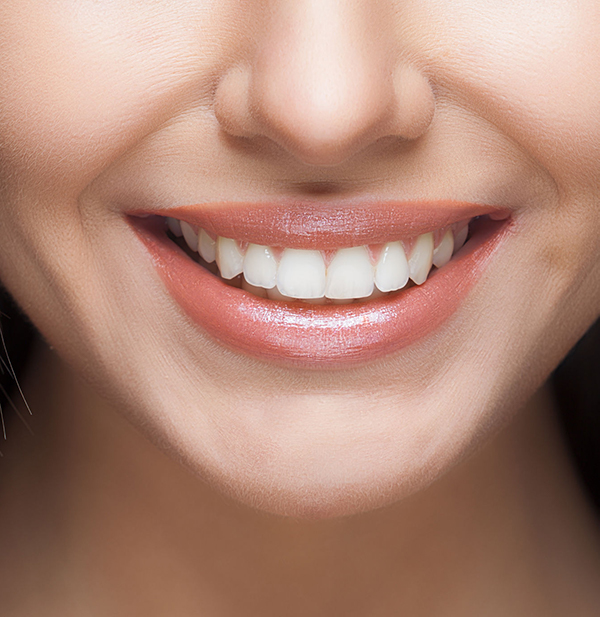 Faccette estetiche Roma Prati