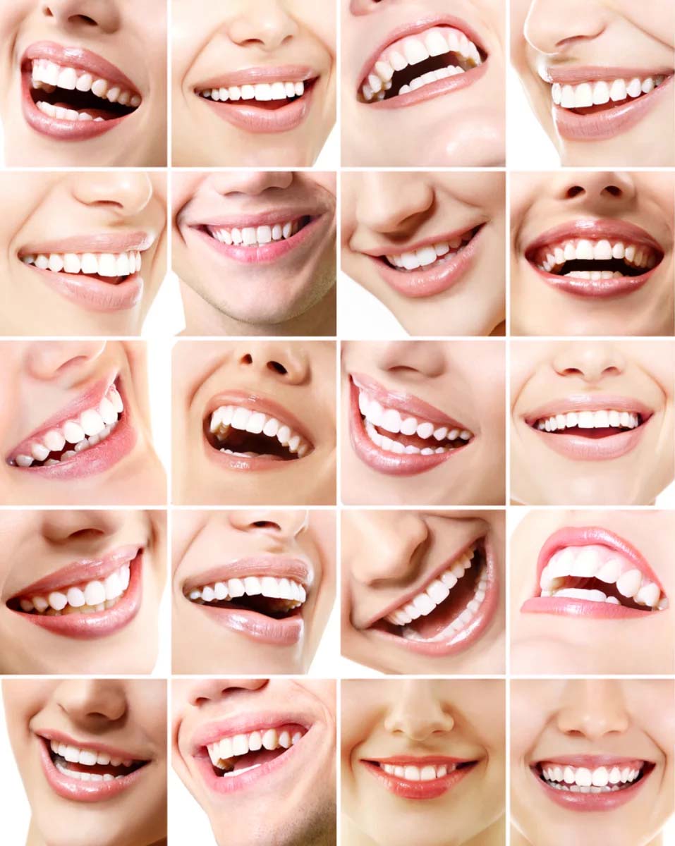 Cause Denti gialli